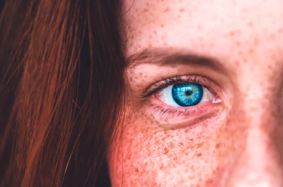 A close-up photo shows part of a face, focusing on the eye.